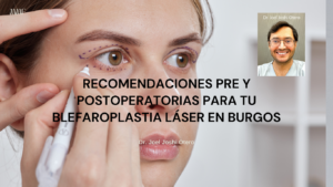 recomendaciones pre y postoperatorias para tu blefaroplastia láser en Burgos