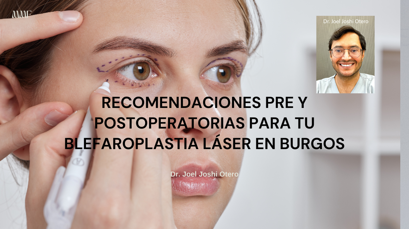 Recomendaciones previas y posteriores a una blefaroplastia láser - Dr ...