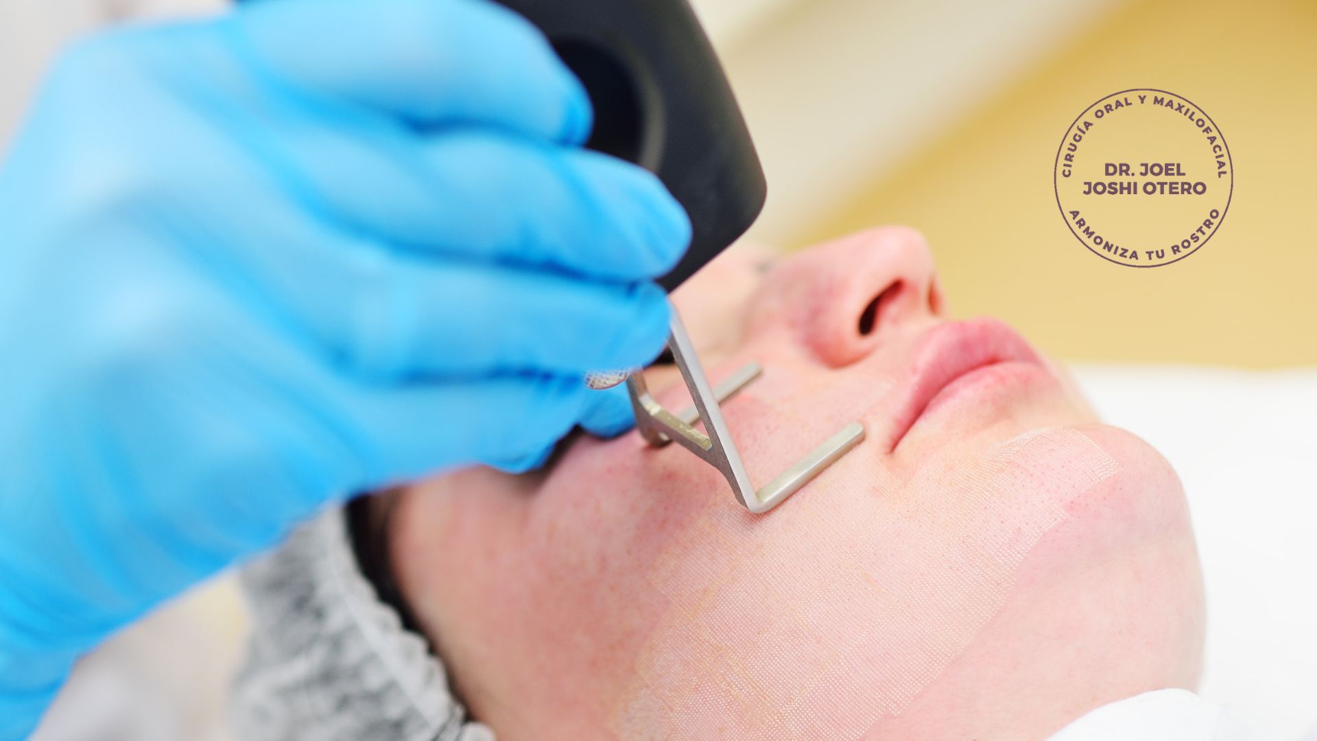 Laser CO2 Dr. Joel Joshi