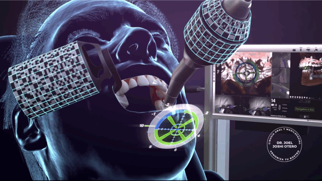 cirugía navegada Dr. Joshi