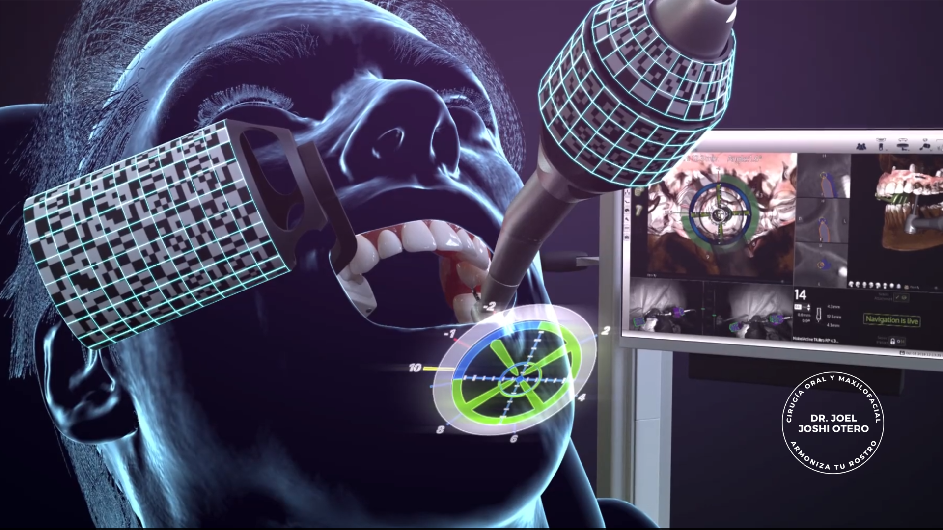 cirugía navegada Dr. Joshi