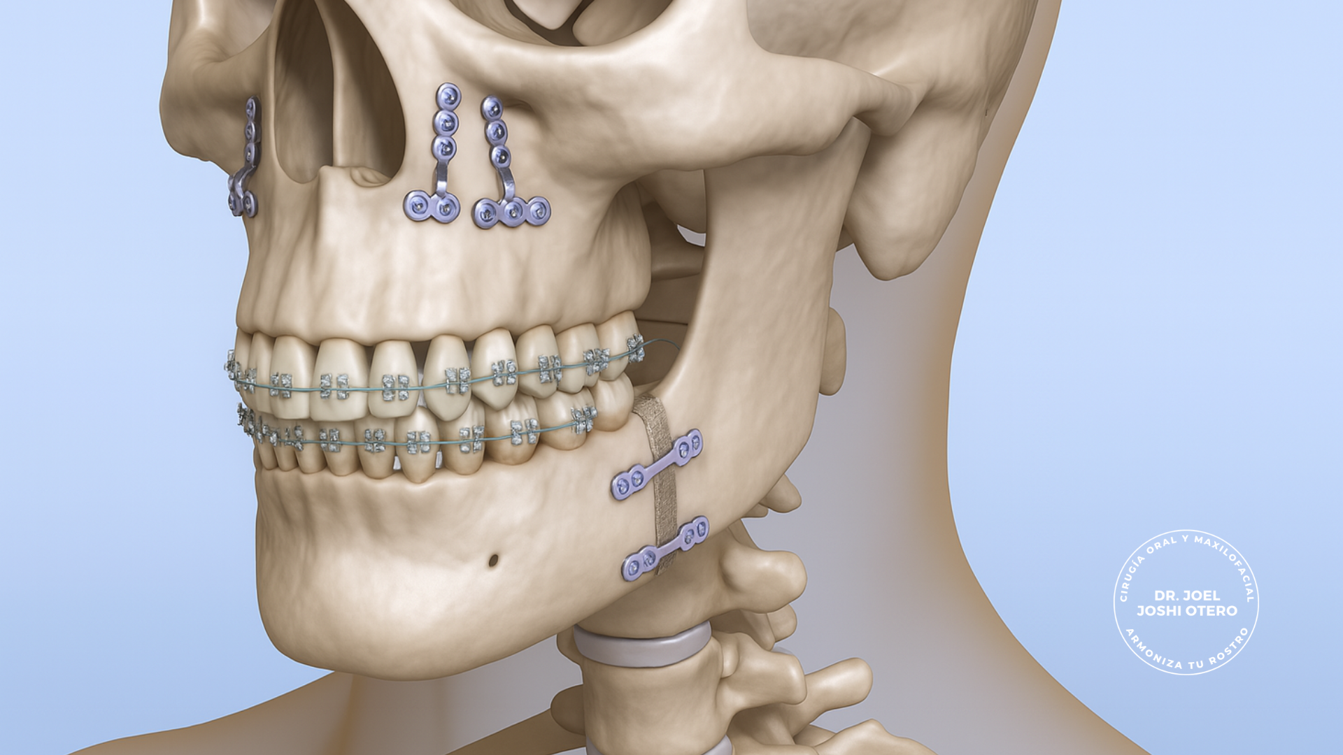 Dr. Joshi cirugía ortognática