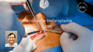 Precios de blefaroplastia Láser CO2