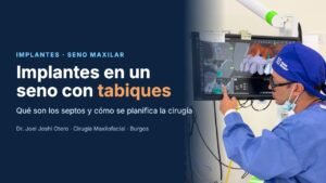 Implantes en un seno maxilar con tabiques: el Dr. Joel Joshi Otero revisa la planificación con navegación dinámica