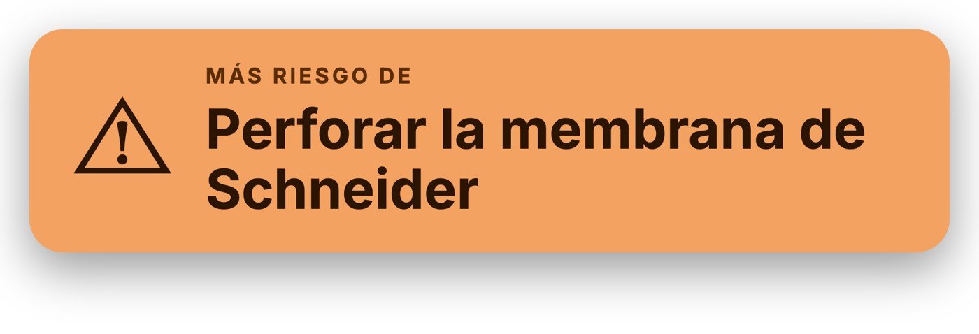 Los septos del seno maxilar aumentan el riesgo de perforar la membrana de Schneider